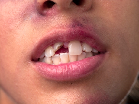 Emergency Dental Problems that Demand Treatment