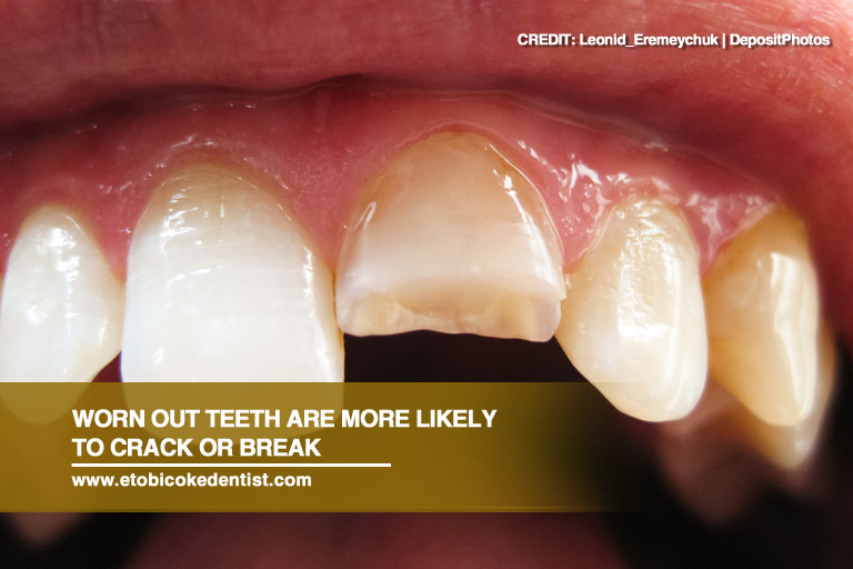 Worn out teeth are more likely to crack or break