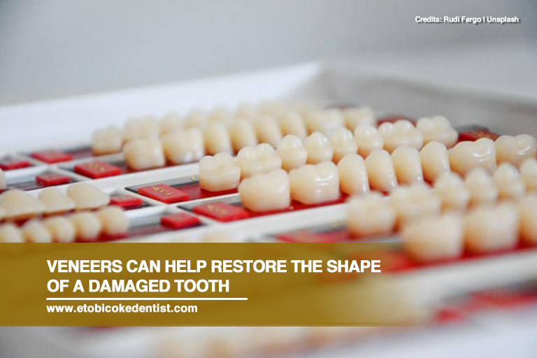 Veneers can help restore the shape of a damaged tooth